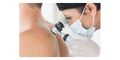 Doctor examining back of patient for skin cancer