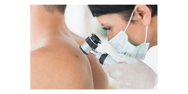 Doctor examining back of patient for skin cancer