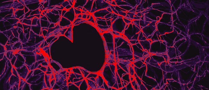 Leeds researchers shortlisted in final of British Heart Foundation image competition