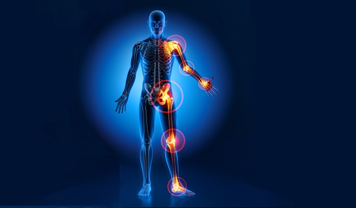 musculoskeletal short course image of joint pain