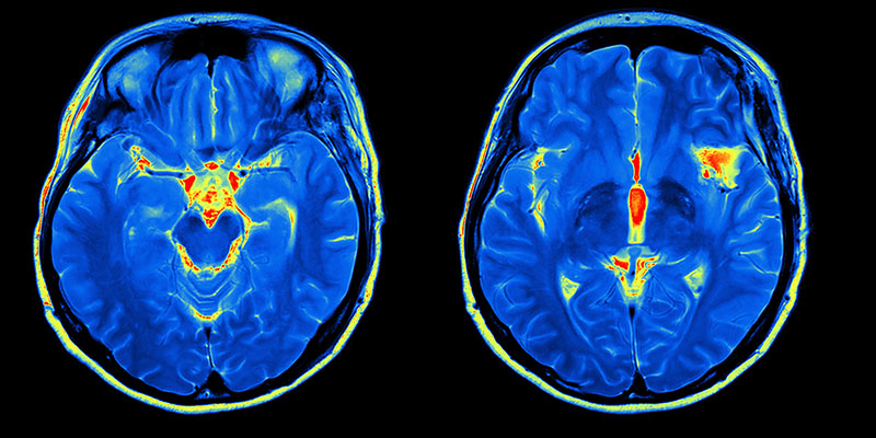 Cognitive Neuroimaging School Of Psychology University Of Leeds