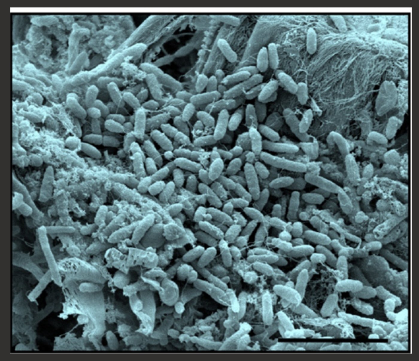 c.difficile biofilm