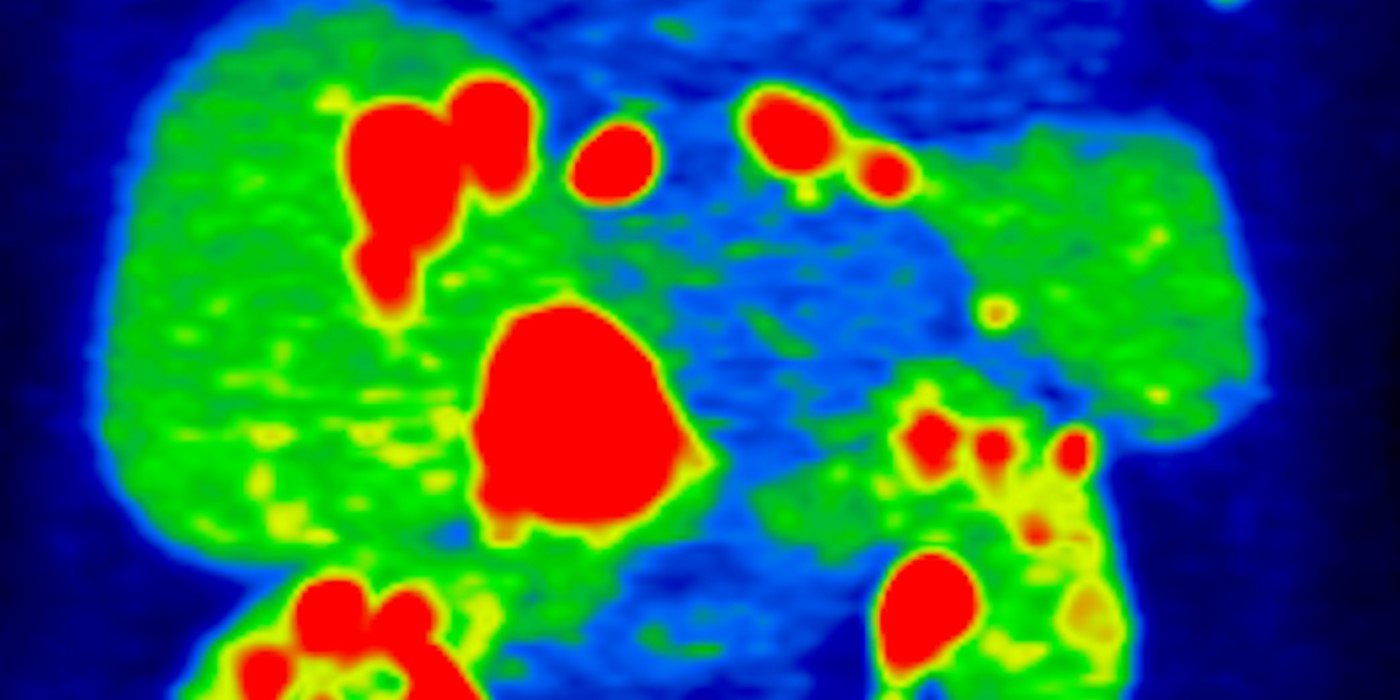 LIMR RAAS Radiology 1400x700