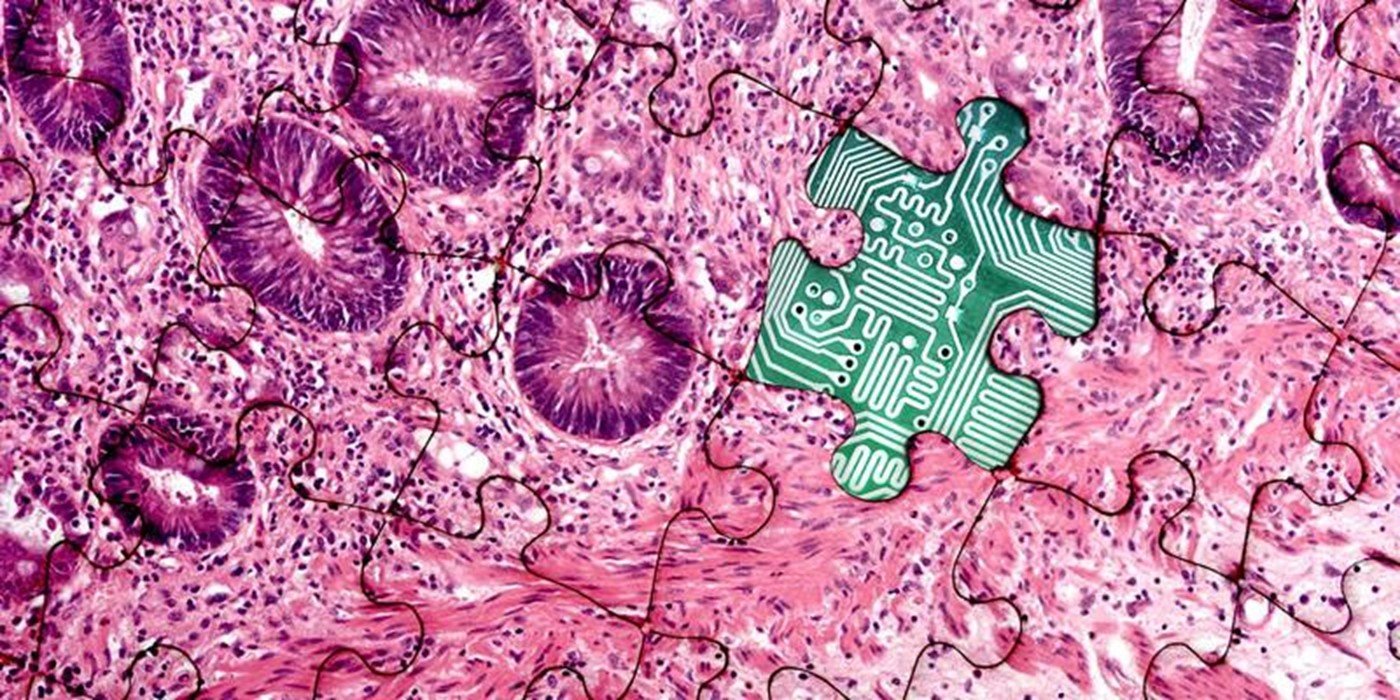 LIMR PADA Digital Pathology 1400x700