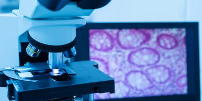 Kinder, smarter leukaemia treatment transforming lives