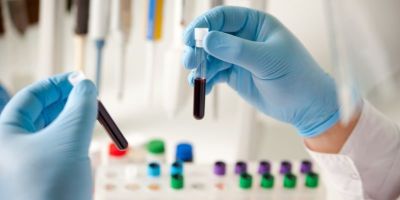 Major study to track impacts of childhood blood disorders