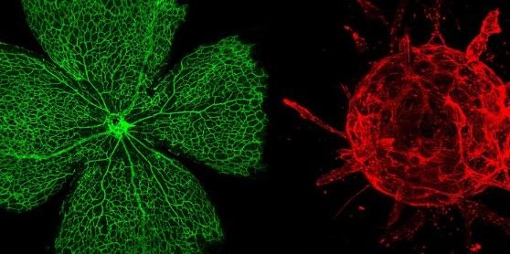 Metabolic Vascular