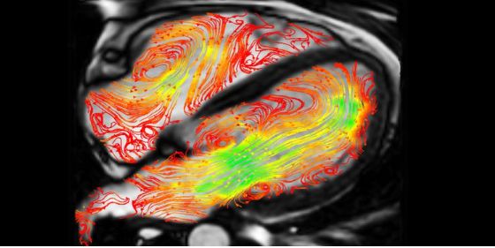 Cardiac image