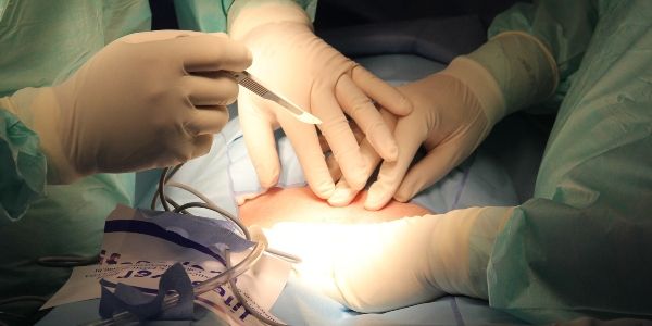 Halving the risk of infection following surgery