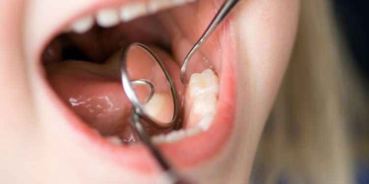 Toothbrushing programme in schools could tackle crisis of tooth decay