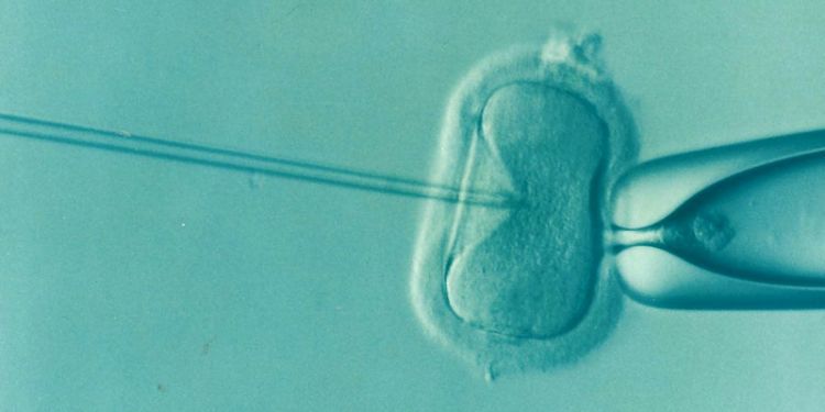 Leeds University research suggests new IVF technique is no more effective than previously available treatments