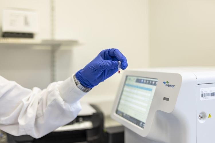 hand holding blood sample next to screen