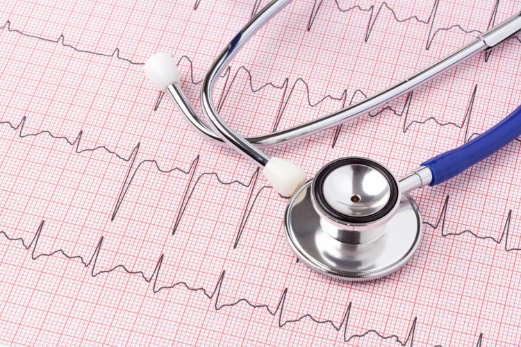 Medical record linkage study discovers that patients receiving low dose steroid are at an increased risk of cardiovascular disease