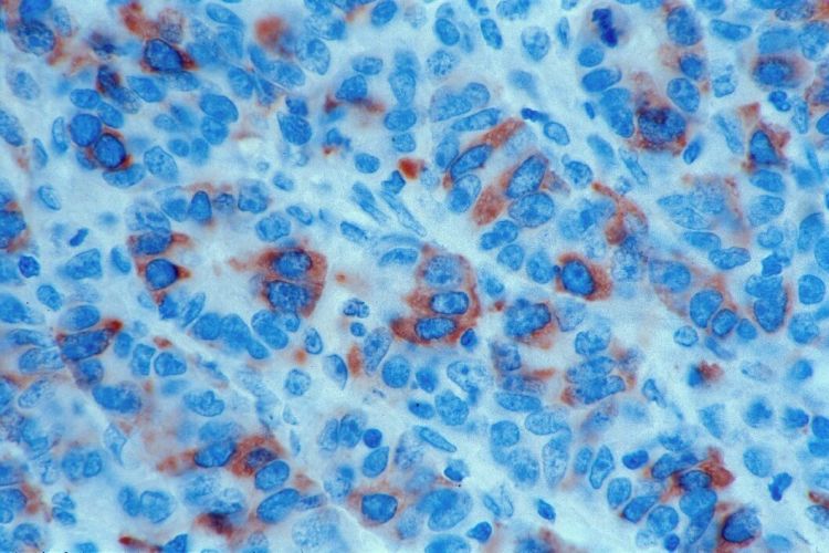 Human Stem Cells And Cancer Origins Discovered In The Stomach For The First Time