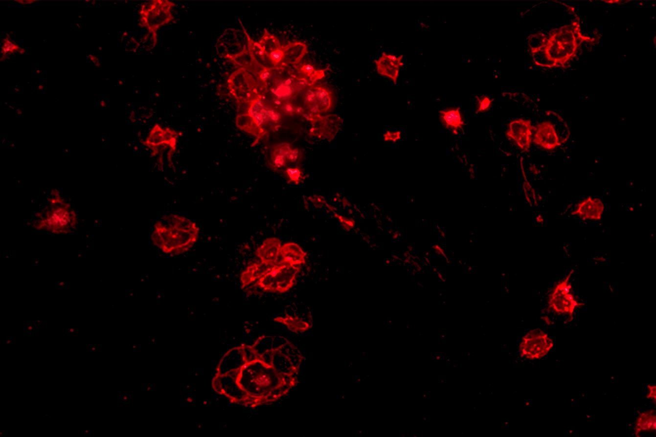 Beth Webb BHF Image competition