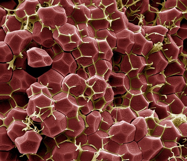 image of fibrin within a blood clot