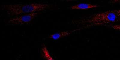 Microscopy image showing human muscle cells with nuclei in blue, and stress caused by the ceramide stress signals shown in red. (Lee Roberts)